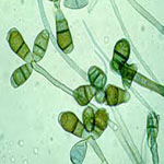 Curvularia lunata spores